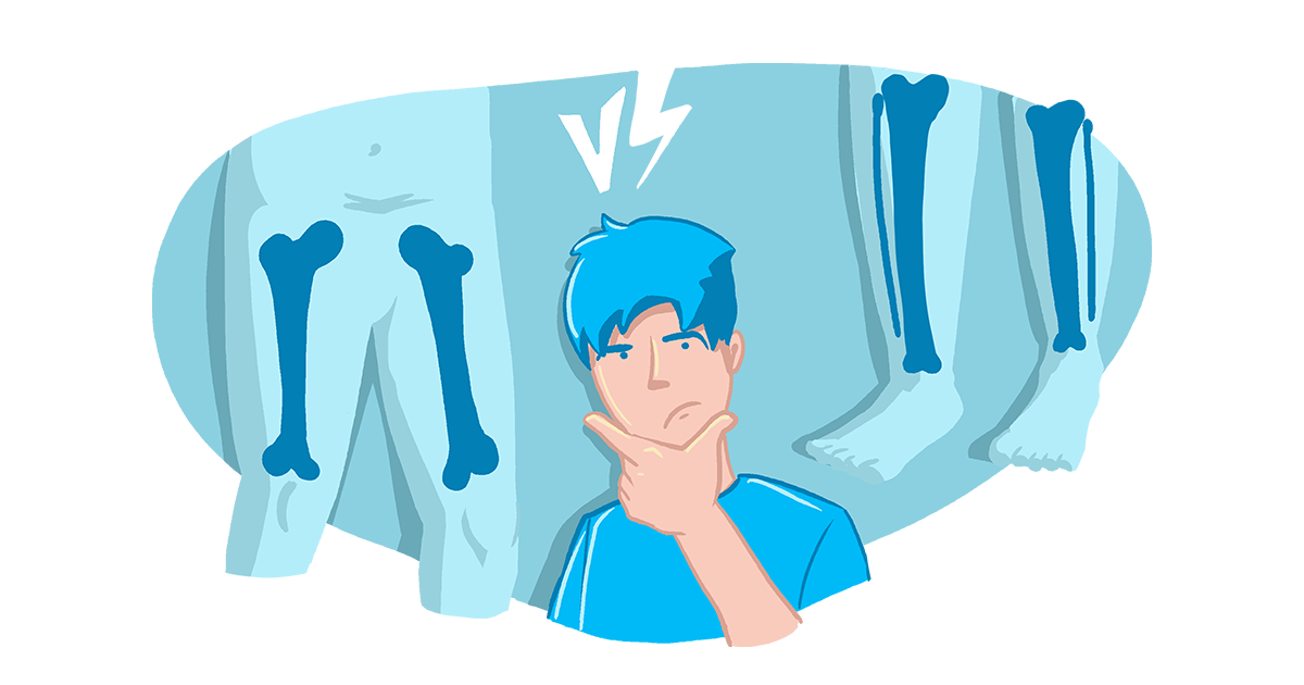 A man with his hand on his chin because he is wondering if he should lengthen his tibia or femurs first. In front of him is an image of femur and tibia bones with the versus between them.